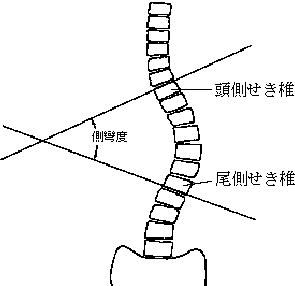 コブ法の方法